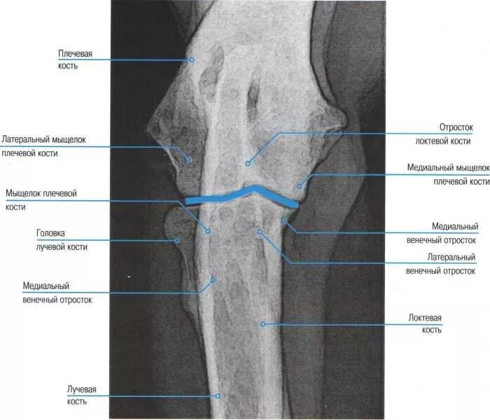 Фрагментация медиального венечного отростка локтевой кости у собак. Медиальный венечный отросток у собак. Венечный отросток локтевой. Локтевой сустав рентген перелом венечного отростка. Локтевого мыщелка