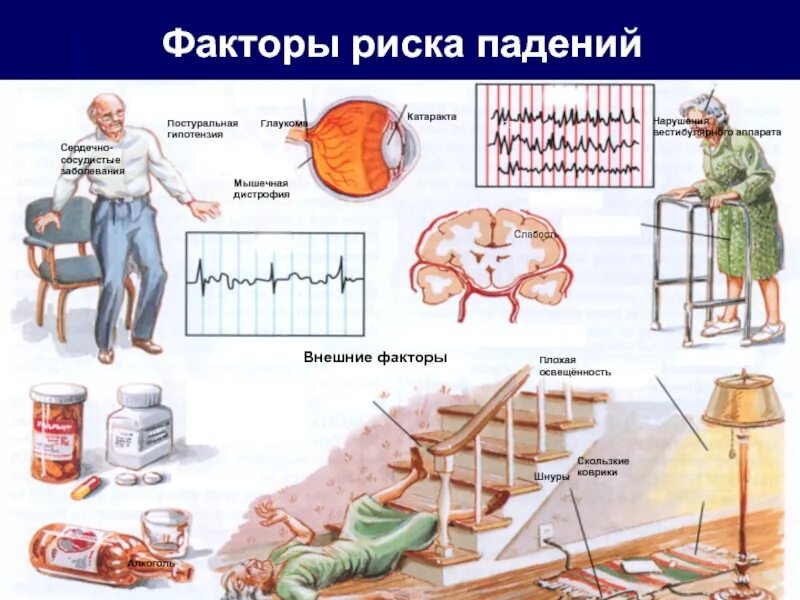 Опасные факторы работы на высоте. Опасность падения. Опасность падение. Опасность падение. Осторожно ступенька.