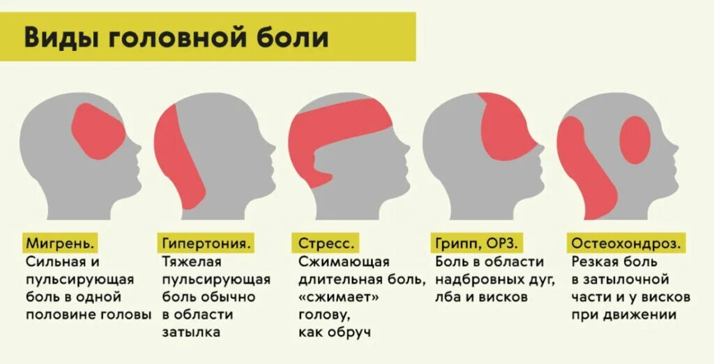 Что делать если голова. Голова болит сзади затылка. причина головной боли сзади головы. болит голова сзади пульсирует почему. боль при нажатии на голову сзади.