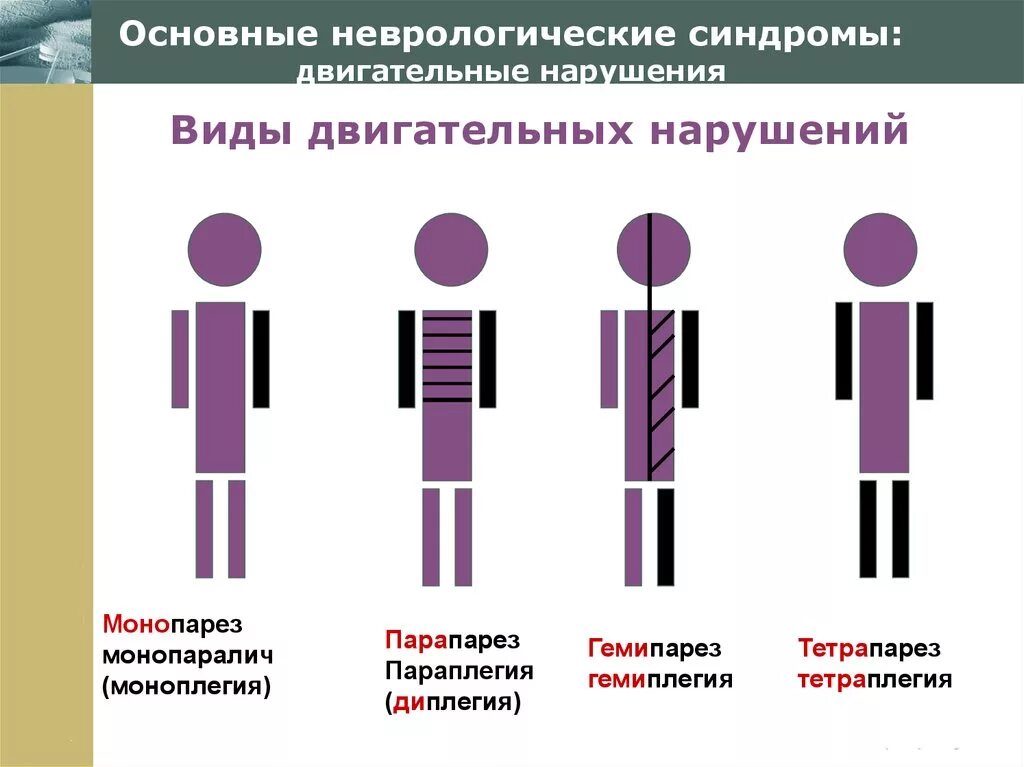 Неврологическое заболевание синдром. Основные симптомы в неврологии. Типы двигательных расстройств неврология. Основные неврологические синдромы. Синдром двигательных нарушений.