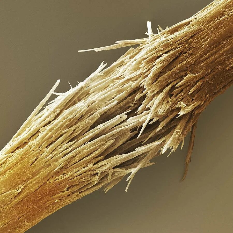 Сильно секутся волосы. Узловатая трихоклазия. Узелковая трихоклазия. Волос под микроскопом. Сеченый волос под микроскопом.