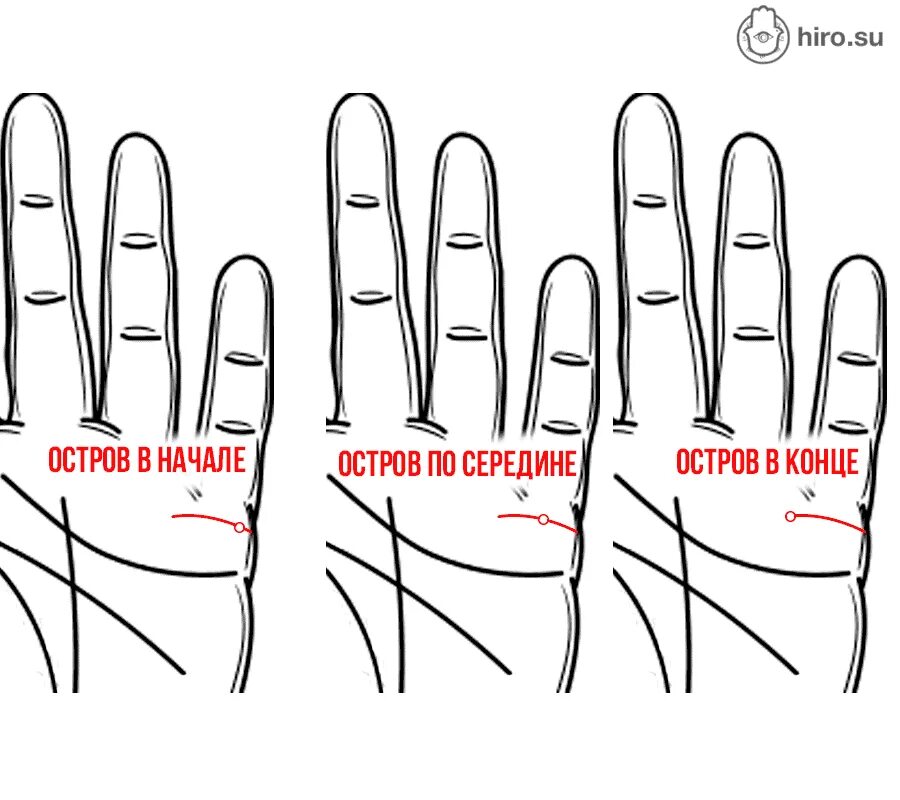 Линия брака. Линия брака островом. Линия брака. Линия замужества на ладони. Вдовство на линии брака.