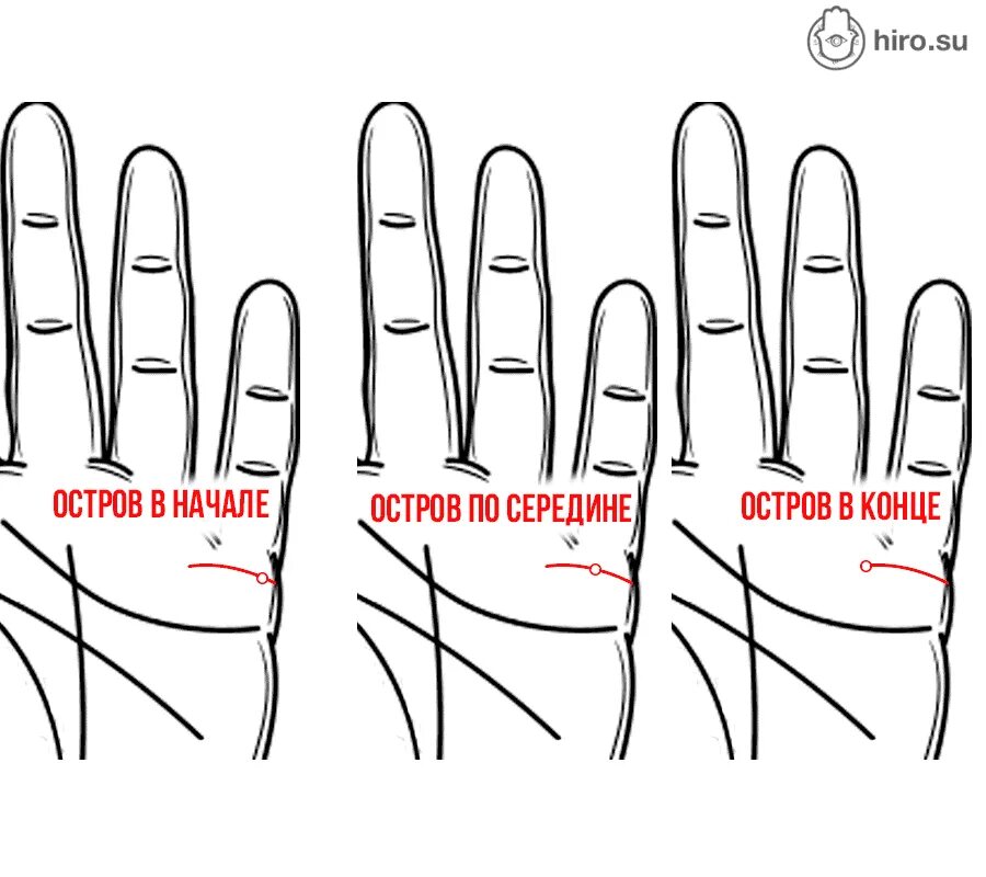 Линия замужества. Хиромантия Датировка линии брака. Хиромантия двойная линия брака. Линия замужества на руке. Линии на руке линия брака.