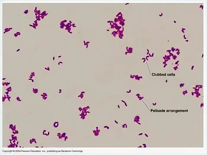 Mobiluncus spp corynebacterium в мазке. Коринебактерии дифтерии микробиология. corynebacterium diphtheriae по грамму. коринебактерии грамположительные. corynebacterium diphtheriae морфология.