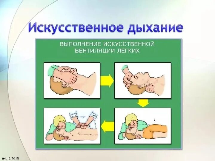 Искуственная вентиляция легких алгоритм кратко. Оказание первой помощи искусственное дыхание. Искусственное дыхание картинки для презентации. Искусственное дыхание ребенку.