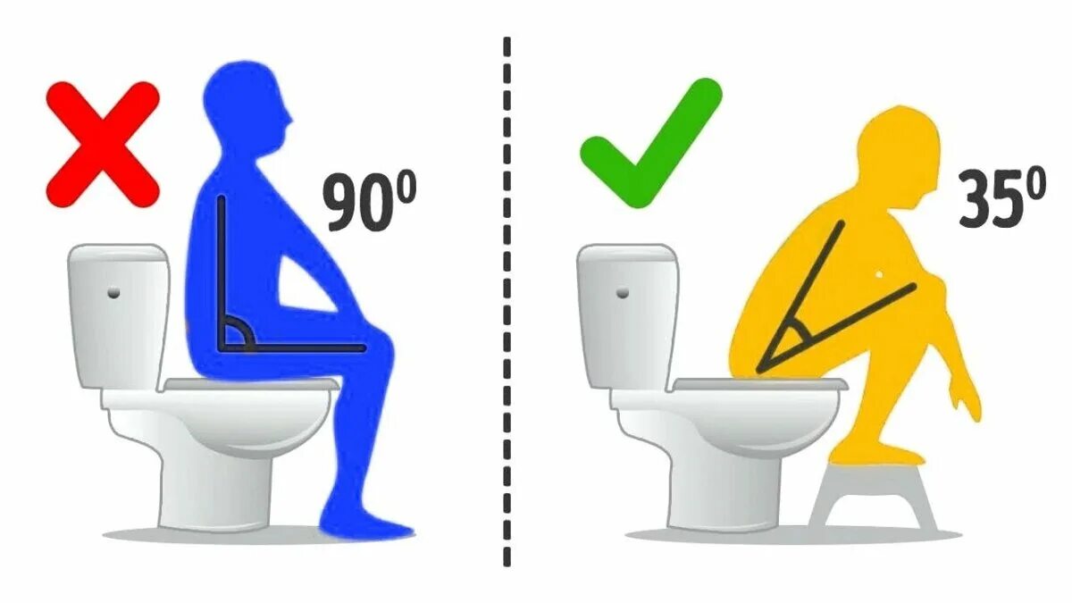 Бывает туалет. Положение тела на унитазе. Правильная поза на унитазе при дефекации. Правильная форма позы на унитазе.
