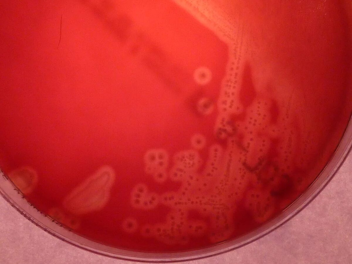 Стрептококкус агаре стрептококк на кровяном. Streptococcus agalactiae на кровяном агаре. Стрептококки на кровяном агаре. Тест стрептококк группы а