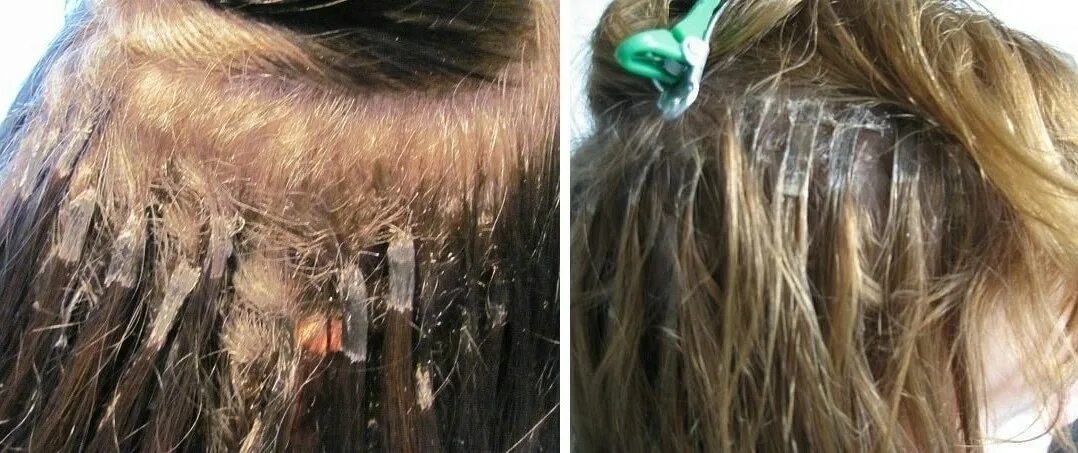 Последствия наращивание. Ленточное наращивание (hair talk, германия). Неудачное наращивание волос. Плохое наращивание волос. Волосы после наращивания.