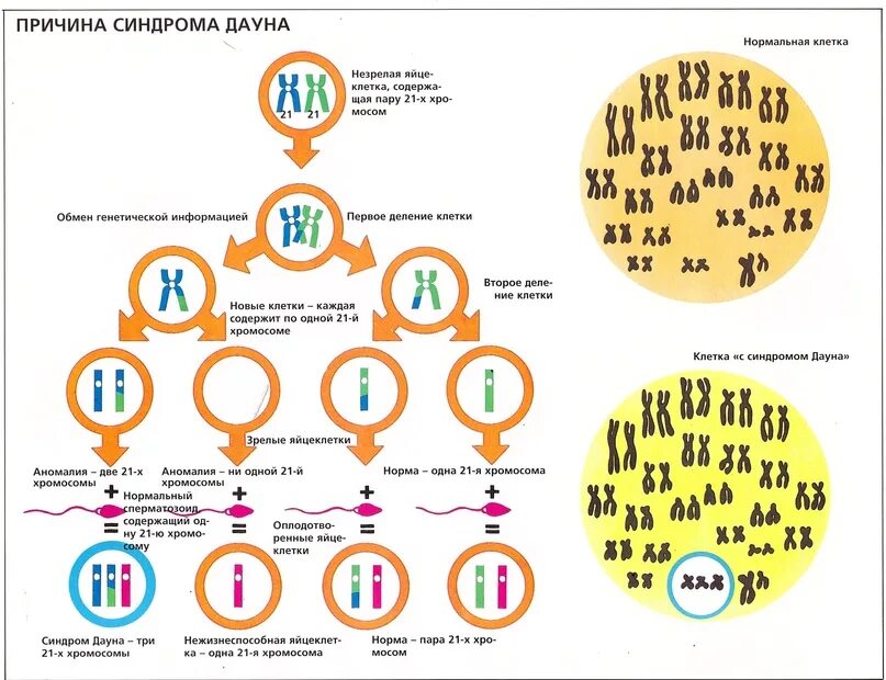Сколько хромосом в кишечнике. Механизм развития синдрома дауна. механизмы формирования синдрома дауна. болезнь дауна набор хромосом. синдром дауна схема хромосом.