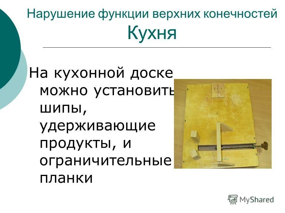 Последствия плоскостопия. Внутрикостная анестезия на верхней конечности. Нарушение функции верхних конечностей. Вялый паралич при полиомиелите. Декортикационная и децеребрационная ригидность.