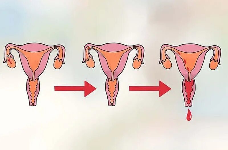 Как у женщины идут месячные. Как происходит менструация. Матка менструационного цикла.
