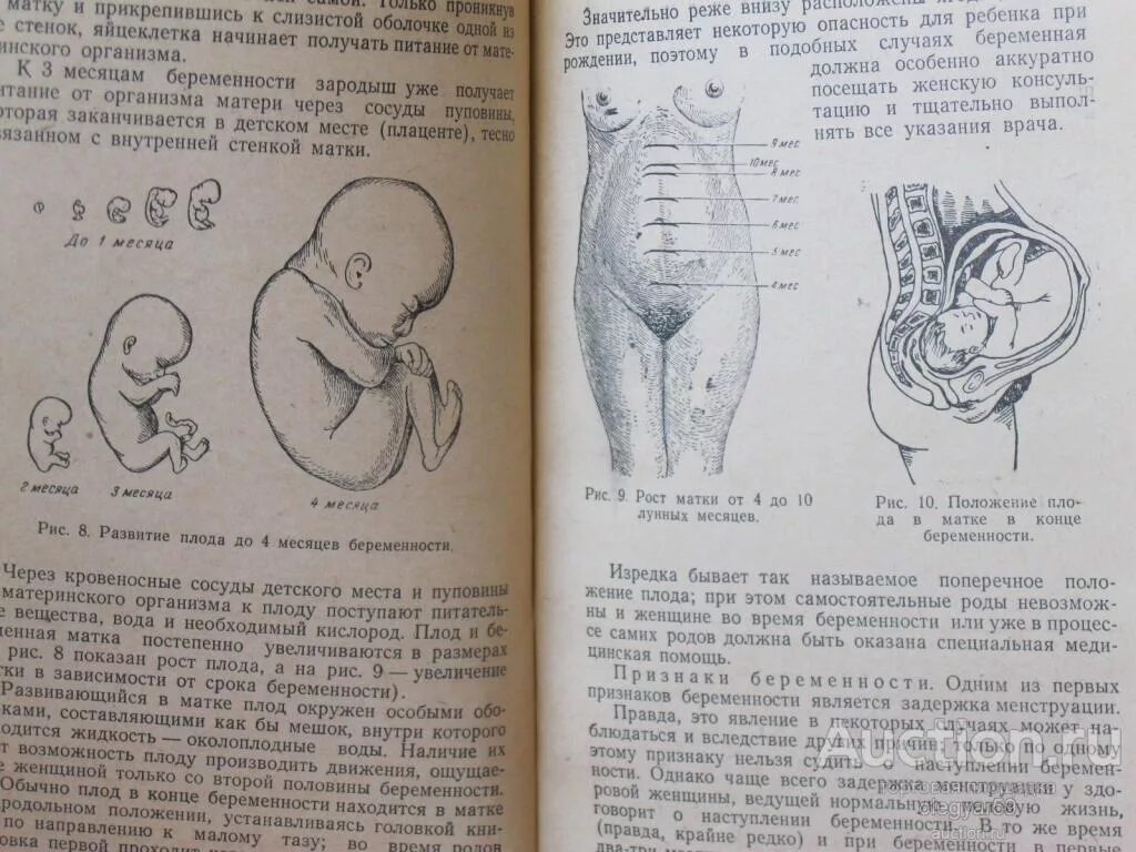 Положение плода в матке по месяцам. Положение ребенка в животе. Расположение плода в животе по неделям. Первые шевеления плода.