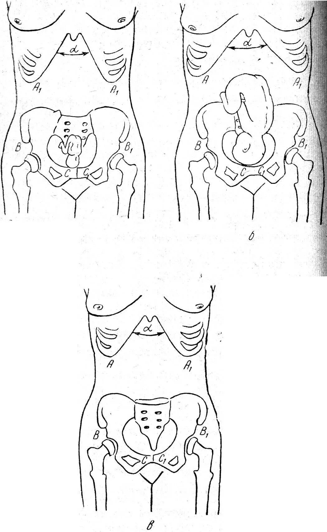 На каком сроке начинают расходиться. На каком сроке начинают расходиться. На каком сроке начинают расходиться. Стадии формирования плода по неделям беременности. Периоды развития плода по неделям таблица.