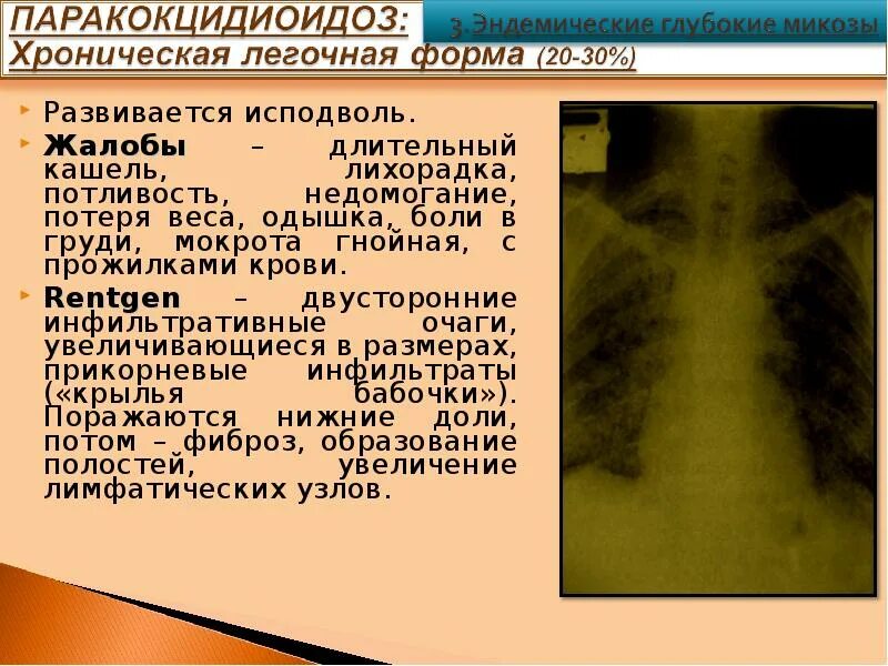 Кашель с прожилками крови при пневмонии. Кашель с кровью что может быть