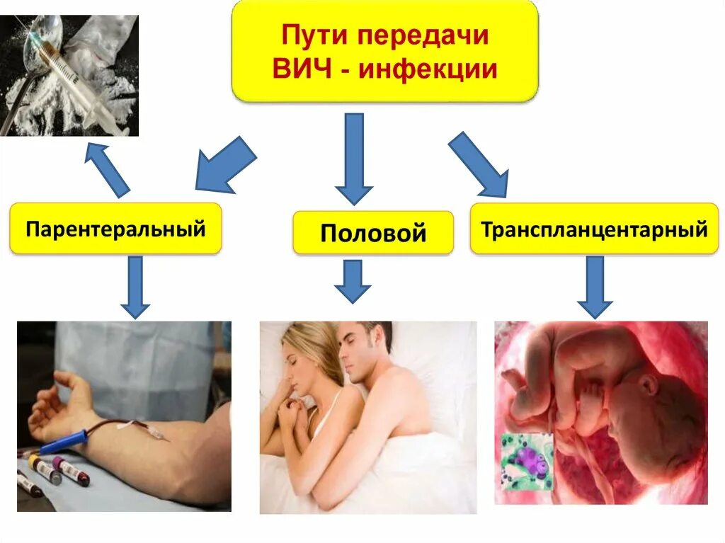 Половой путь заражения вич. Пути передачи ВИЧ инфекции. Парентеральный путь передачи ВИЧ-инфекции. Способы передачи СПИДА.