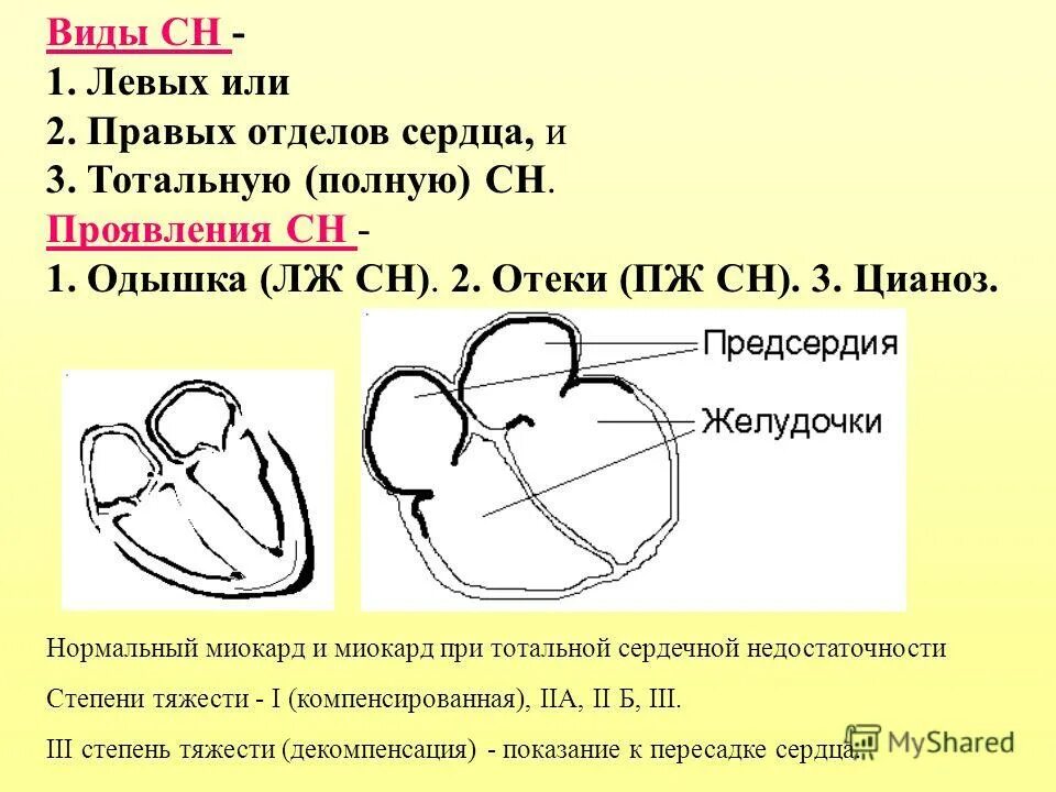 правые и левые отделы сердца. коллабирование правого предсердия при. ответственность отдела маркетинга. правые отделы. права и обязанности маркетолога.