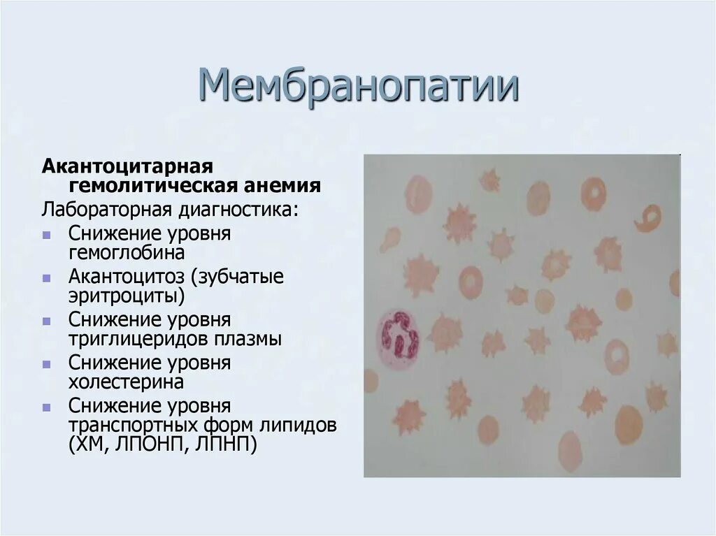 Эритроциты отсутствуют