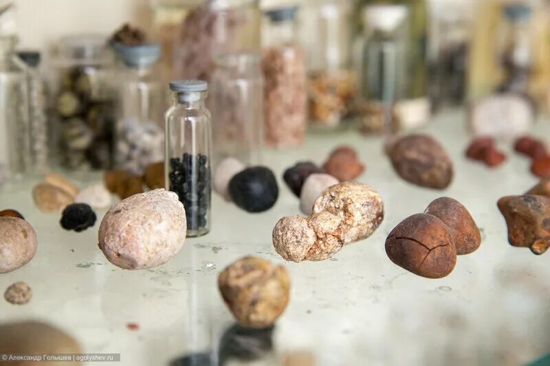 желчекаменная болезнь холелитиаз. лямблиоз в желчном пузыре. камни из желчного пузыря. желчекаменная болезнь макропрепарат. уратные почечные камни.