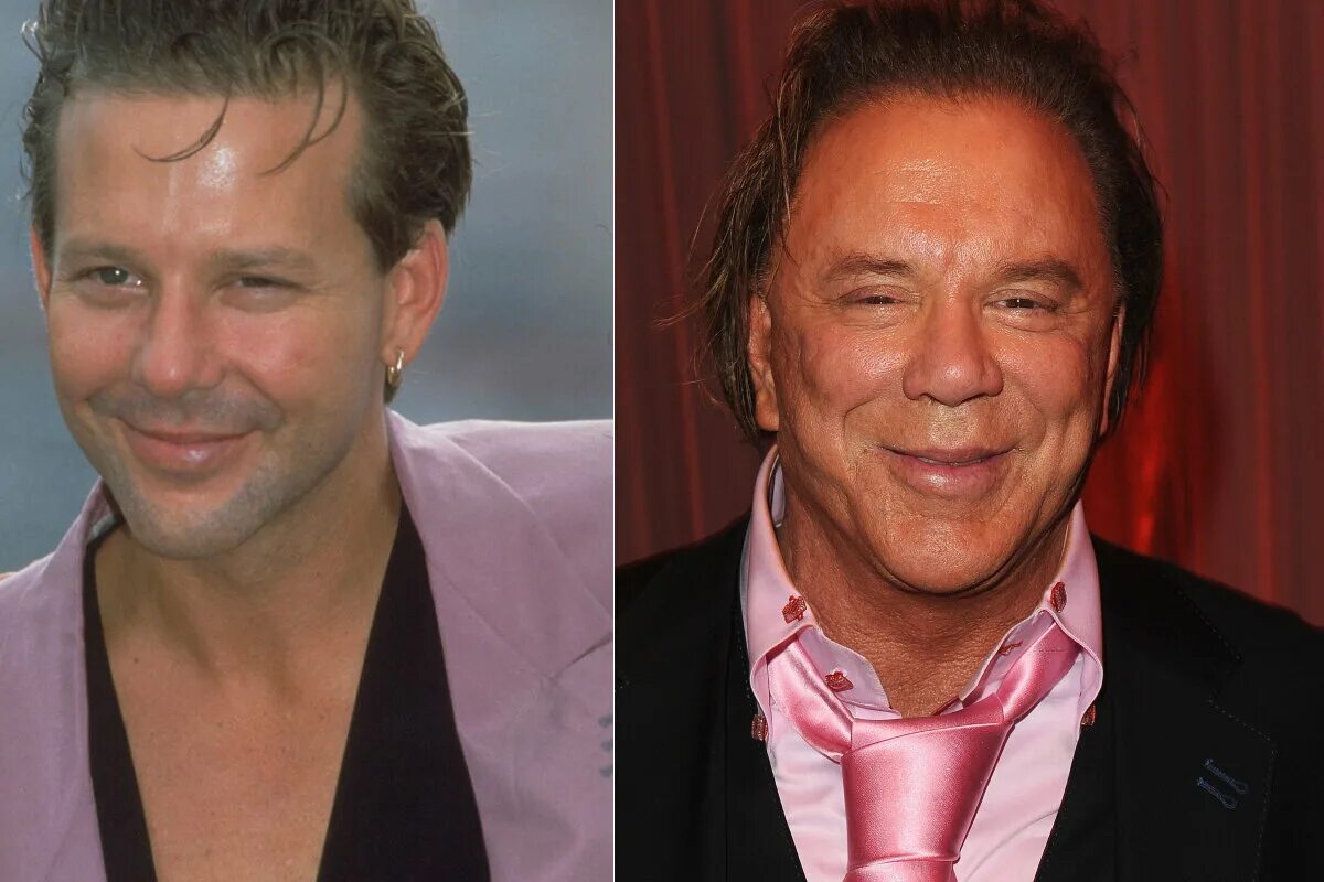 Микки рурк пластические операции. Микки рурк пластические операции. Микки рурк пластики. Микки рурк пластические операции. Микки рурк до пластической операции.