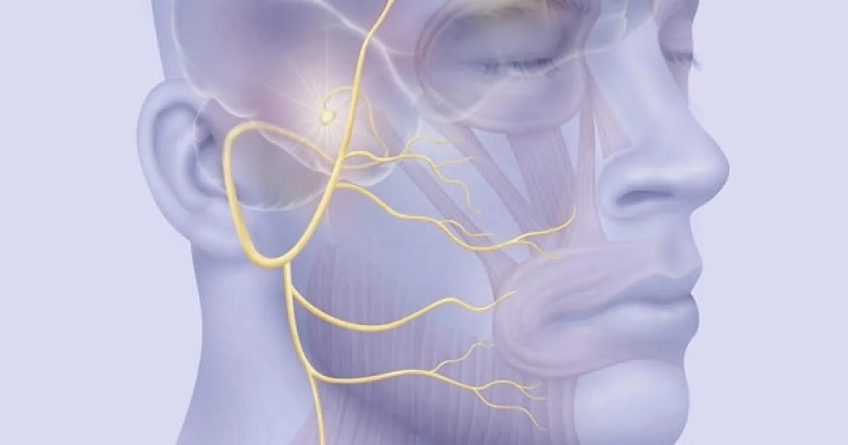 Левый лицевой нерв. Невропатия тройничного нерва. Неврит тройничного нерва неврология. Нейропатия тройничного нерва. Прозопалгия тройничного нерва.
