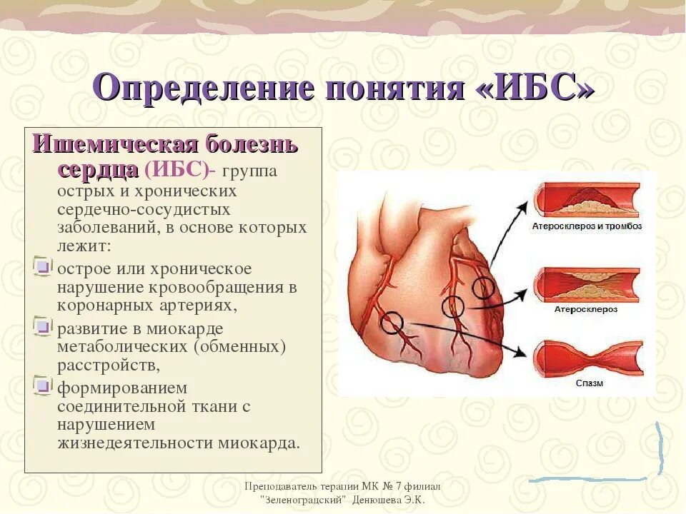 Ишемия причины симптомы. Ишемичкскаяболезнь сердца. Ишемическая болезнь сердца (ИБС).