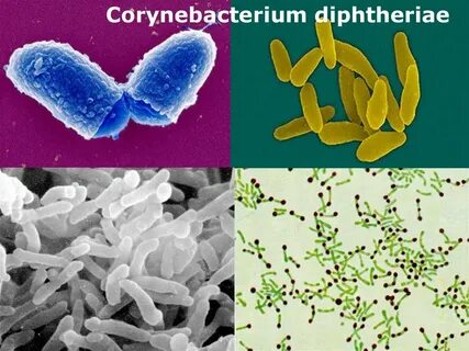 Corynebacterium