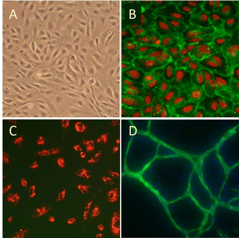 антинуклеарный фактор 1:5120 гомогенный тип. Hela клетки. Hep 2 клетки. клеточная линия hep 2. клеточная линия hep 2.