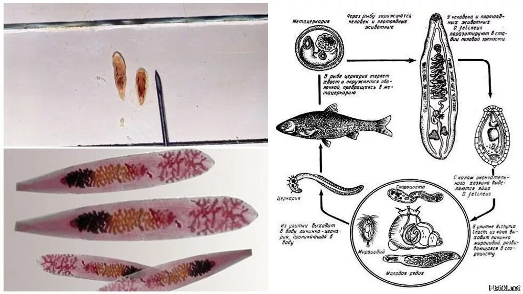 Кошачья двуустка какое развитие. Сибирская двуустка жизненный цикл. Цикл развития кошачьей двуустки. Жизненный цикл кошачьей двуустки Opisthorchis felineus.. Описторхоз схема цикла развития.