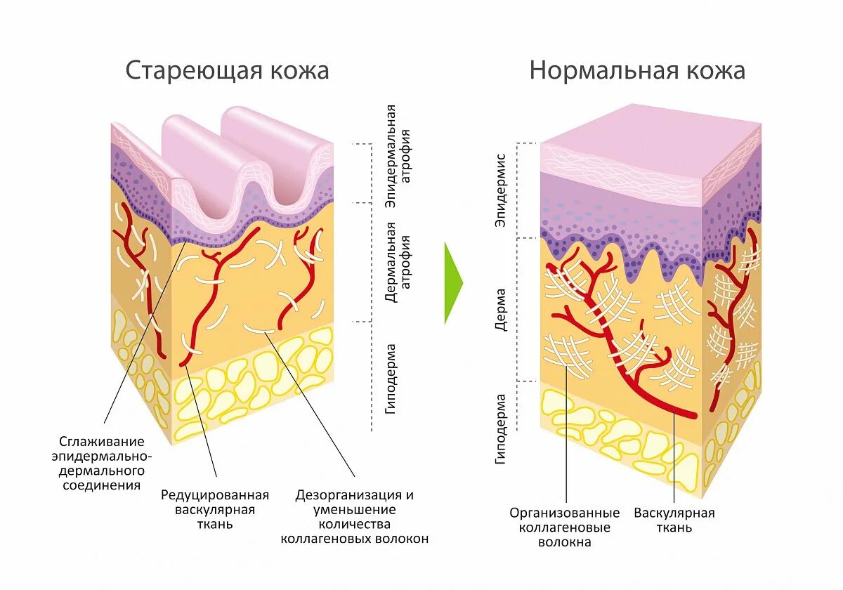 Коллаген в коже схема. Строение кожи лица. Коллагеновый слой кожи. Кожа в разрезе.