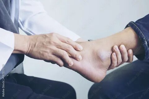 Боли в костях нижних конечностей