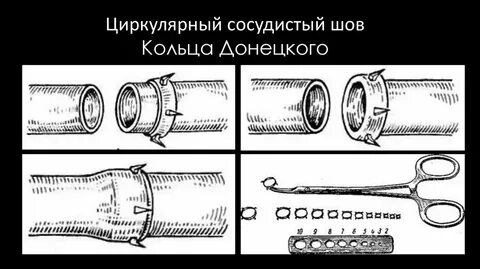 Механический сосуд