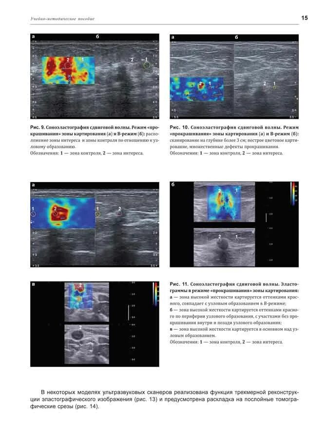 Соноэластография ультразвуковая эластография. Эластография сдвиговой волны. Ультразвуковая компрессионная эластография. Эластография сдвиговой волны печени.