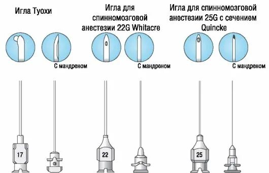 Игла спинальная типы. Игла Бира с мандреном для люмбальной пункции. Игла с мандреном для спинномозговой пункции. Игла для люмбальной пункции с мандреном. Иглы для люмбальной пункции Размеры.