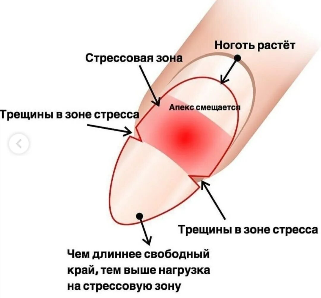 Трещина ногтя гель. Стрессовая зона ногтя. Свободный край ногтя. Архитектура ногтя. Трещина в стрессовой зоне ногтя.