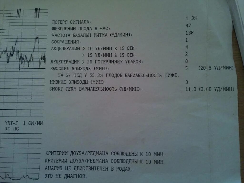 34 неделя беременности шевеления плода. Ктг плода на 32 неделе беременности. норма кто плода 30 недель. вариабельность ктг плода норма 32 недели. расшифровка ктг плода 34 недели беременности.