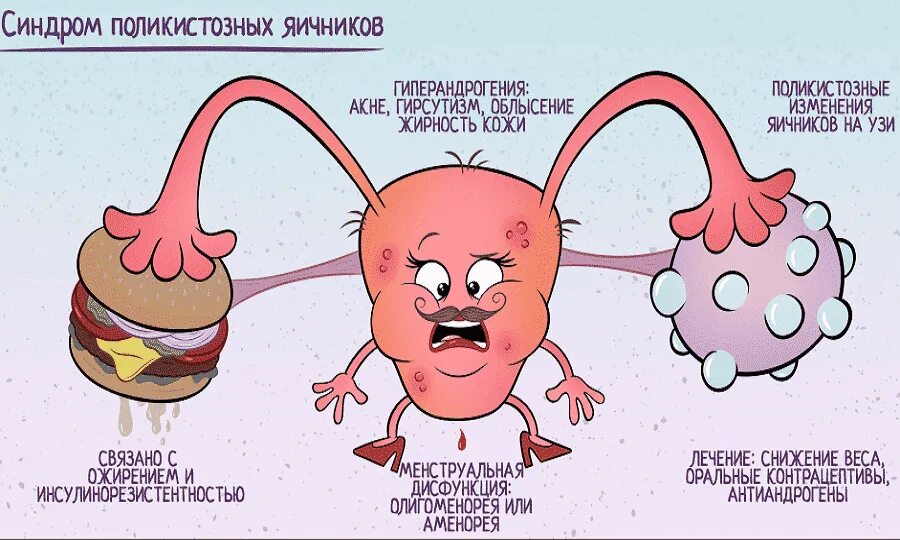 Яичник у мужчин лечение. Поликистозная структура яичников. Синдром поликистоза яичников.