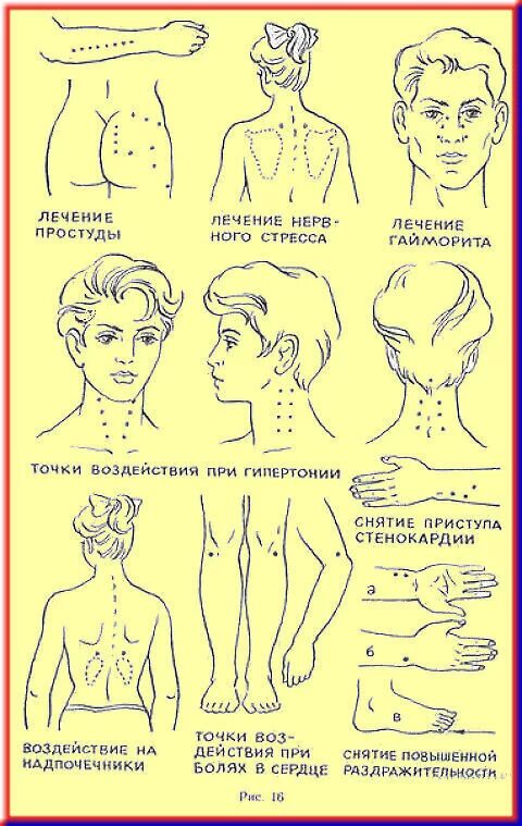 Основа точечного массажа. Акупрессура точечный массаж акупунктура. Точки на теле при массаже. Точечный массаж схема. Точечный массаж при разных заболеваниях.