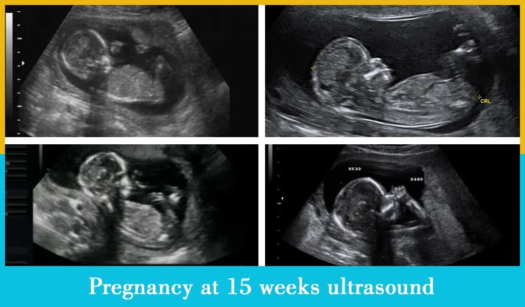 CRL Ultrasound weeks of pregnancy. Pregnancy 12 weeks Ultrasound System. 15 Недель беременности. 15 неделя 2023