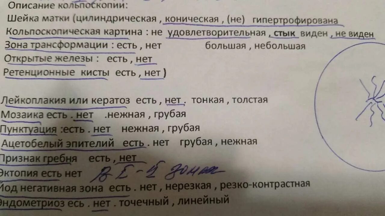 Заключение после биопсии шейки матки. Кольпоскопия анализ. Дисплазия шейки матки протокол. Анализ на биопсию шейки матки. Заключение на дисплазию.