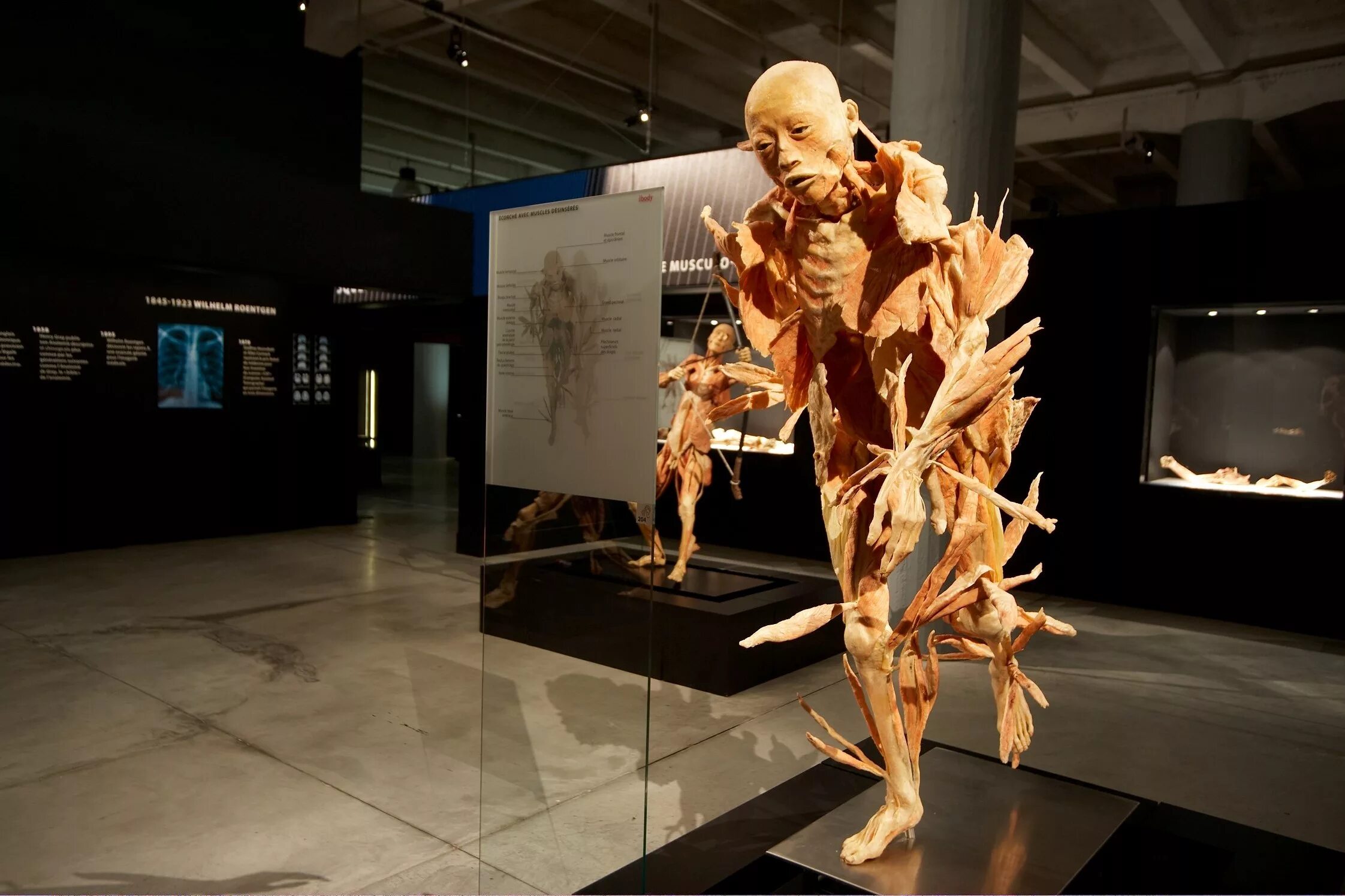 Анатомический музей москва вднх. Музейчеловечиского тела в нидерландах. Музей человека санкт-петербург. Музей строения человека. Музей человека живые системы вднх.