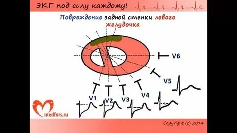 Сила экг