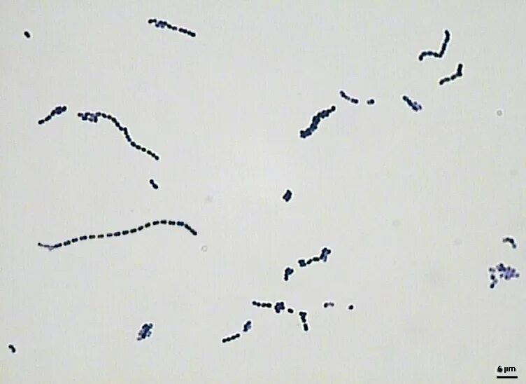 Streptococcus thermophilus. Streptococcus thermophilus