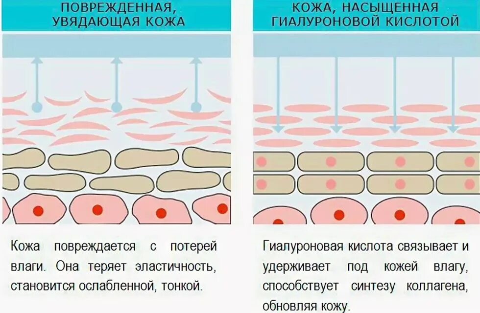 Гиалуроновая кислота где. Какие клетки кожи синтезируют гиалуроновую кислоту. Введение гиалуроновой кислоты в глубокие слои кожи. Гиалуроновая кислота в коже. Схема действие гиалуроновой кислоты.