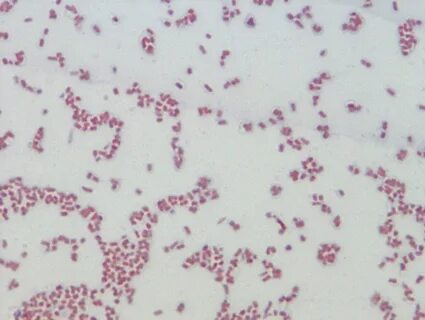 Enterobacteriaceae норма в мазке
