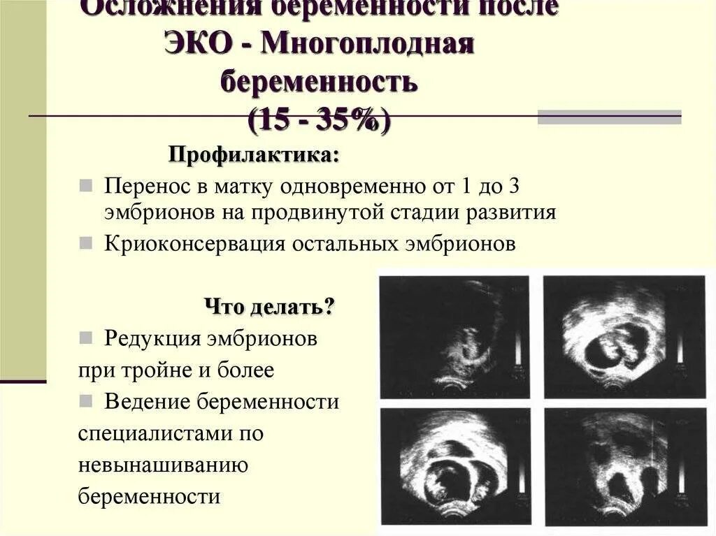 Подсаживали 2 эмбриона. Многоплодная беременность эко. Редукция эмбриона при многоплодной беременности. Редукция многоплодной беременности что это. Осложнения многоплодной беременности.