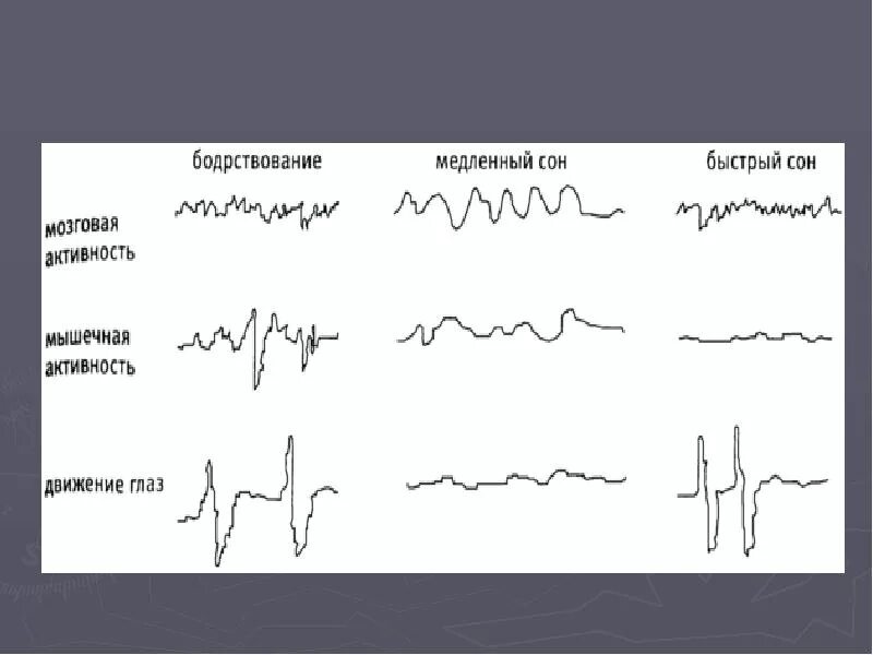 Быстрый и медленный сон. Быстрый сон и медленный сон. Движение глаз в медленном сне. ЭЭГ медленного сна. Чем характеризуется медленный и быстрый сон