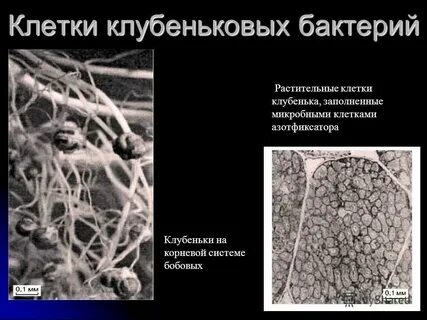 Азотфиксирующие бактерии