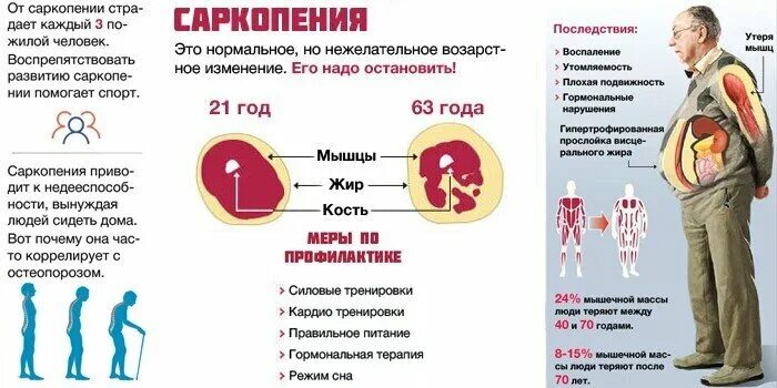 Саркопения это простыми словами. Потеря мышечной массы с возрастом. Саркопения. Саркопения у пожилых саркопения у пожилых. Саркопения симптомы.