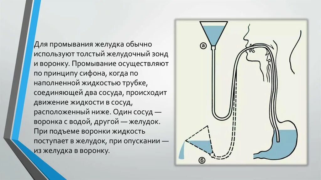 Зондовое промывание желудка(толстый зонд). Назогастральный зонд промывание алгоритм. Составление схемы – алгоритма «промывание желудка». Техника промывания желудка через зонд алгоритм.