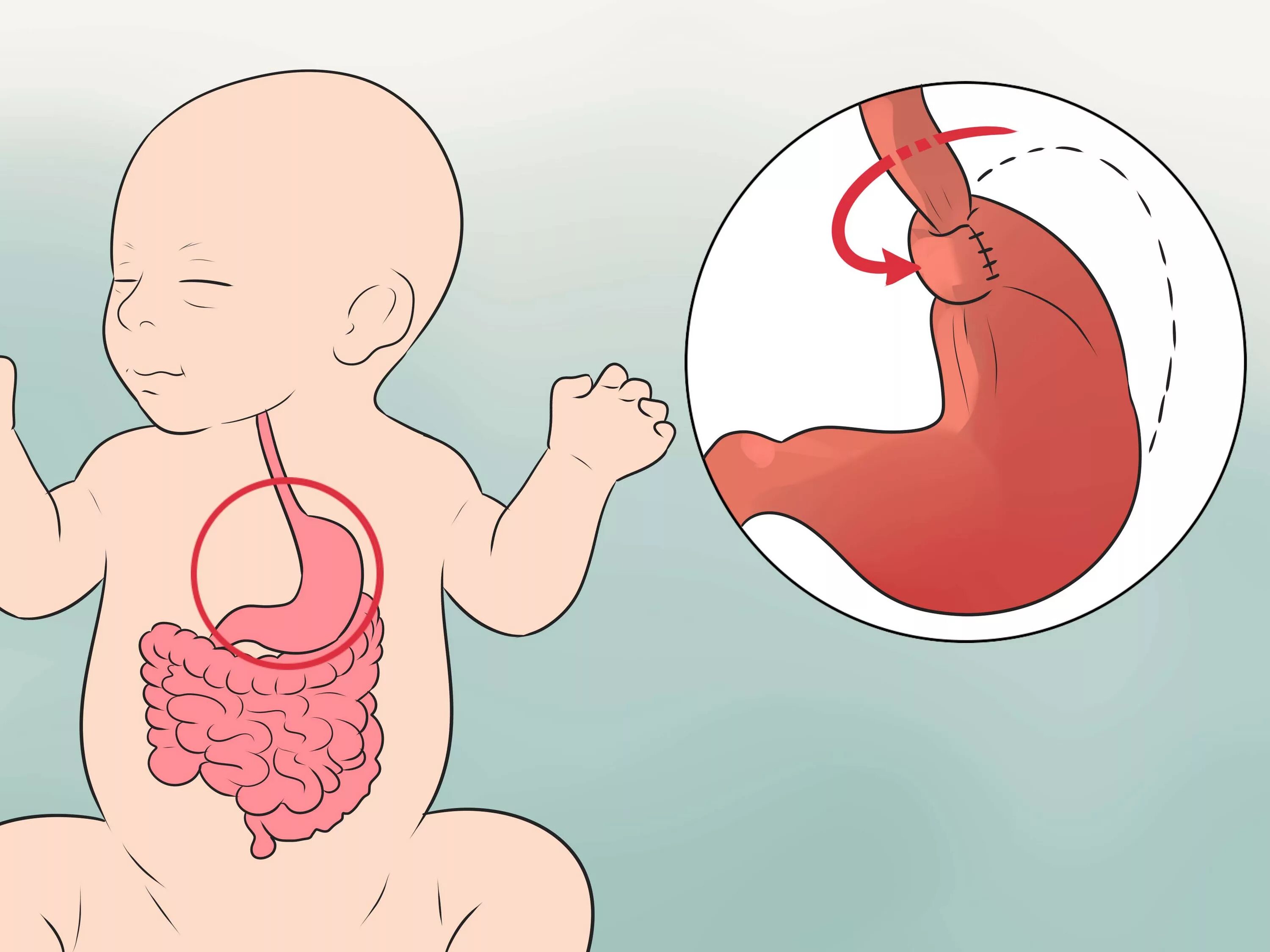 Заболевания желудка у детей. Желудок детей раннего возраста. Пищевод и желудок у детей.